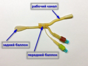 Катетер для дренирования околоносовых пазух (синус - катетер) фото 3325
