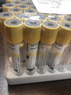 Пробирка вакуумная 9 мл  для исследования мочи  фото 5661