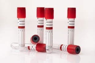 Пробирки вакуумные с красной крышкой без наполнителя, 10 мл (100 шт) фото 5656