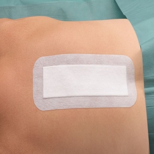 Космопор E стерил - пластырная повязка 15 см х 6 см (Cosmopor E steril) фото 4367